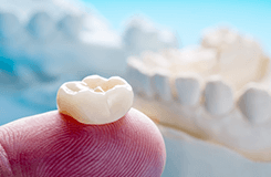 dental crowns breese illinois