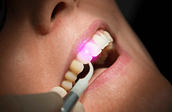 laser dental treatment highland illinois