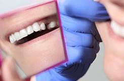 tooth extraction dental services highland illinois