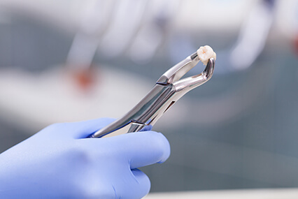 tooth extraction services highland illinois