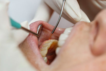 restorative dentistry in greenville illinois